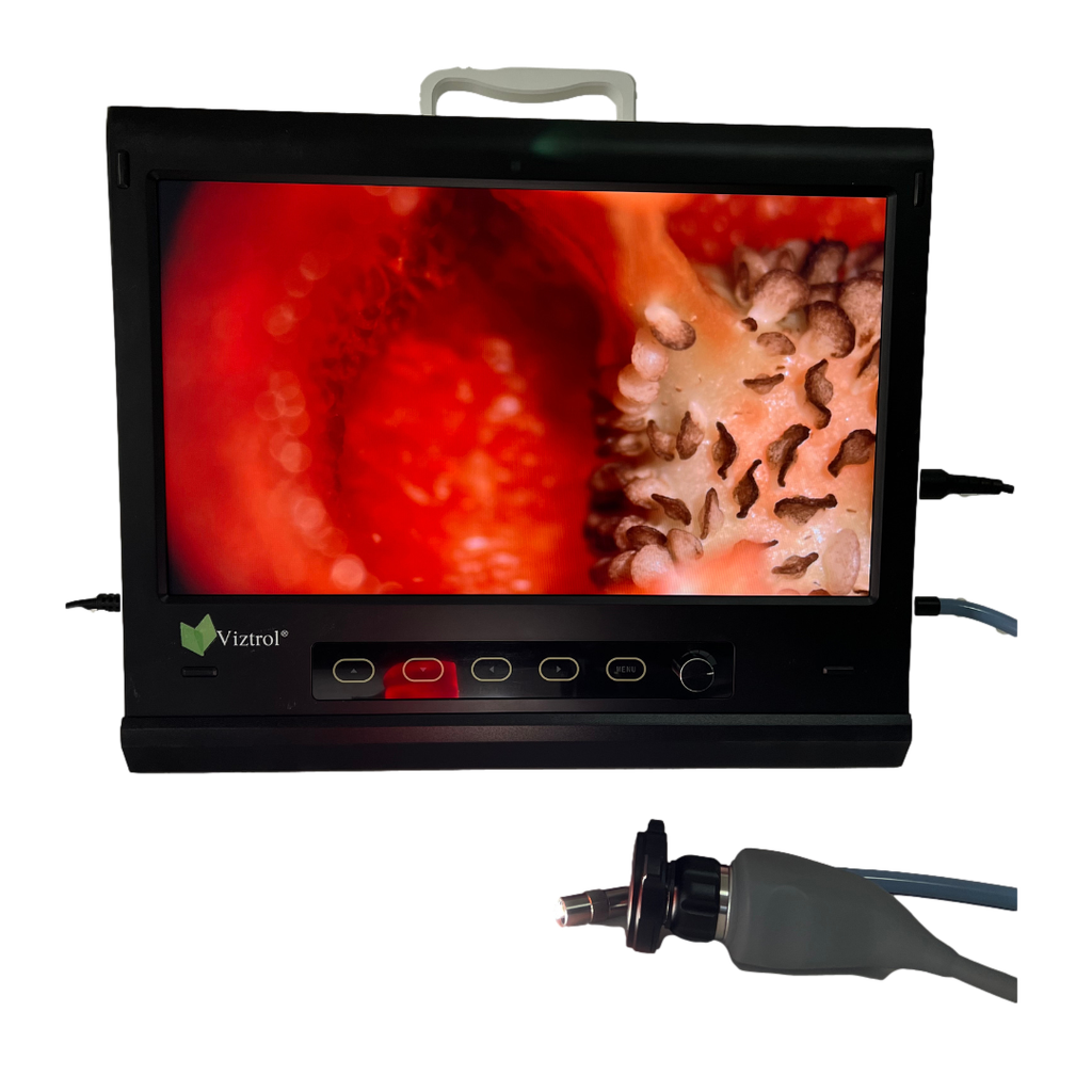 Sistema de Video Endoscopico 19